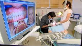 Lucky Liz has some new Veneers fitted - 10 Years Younger