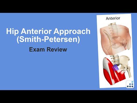 Hip Anterior Approach (Smith-Petersen) Exam Review - Doug Padgett, MD