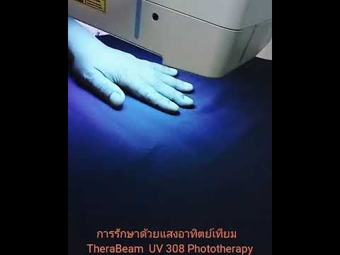 ภาพบางส่วนที่จะใส่ในโรคสะเก็ดเงิน การเกิดโรคภูมิแพ้โรคผิวหนังวิทยาภูมิคุ้มกัน