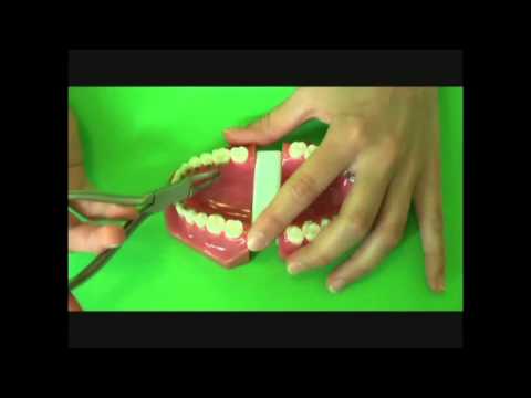 2D Lingual - Bogen einlegen und Klammer schließen