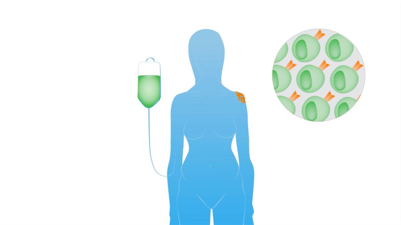 Adoptive Cell Therapy: Turning Immune Cells into Cancer Fighters