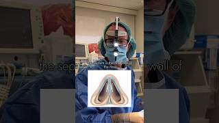Yael Halaas MD