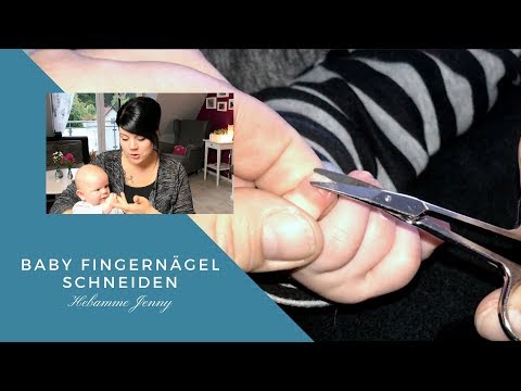 Gribok des Nagels auf den Händen die Volksmethoden Die Behandlung panarizija des Nagels der Hand