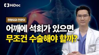석회성 건염, 크기보다 중요한 치료 기준은? l 정형외과 선지호 원장