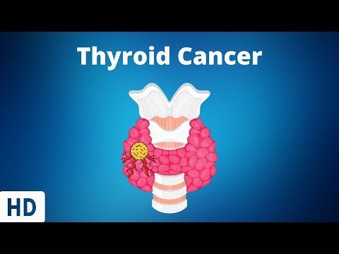 Graves Disease Everything You Need To Know