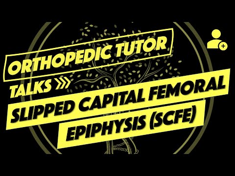 Slipped Capital Femoral Epiphysis (SCFE)