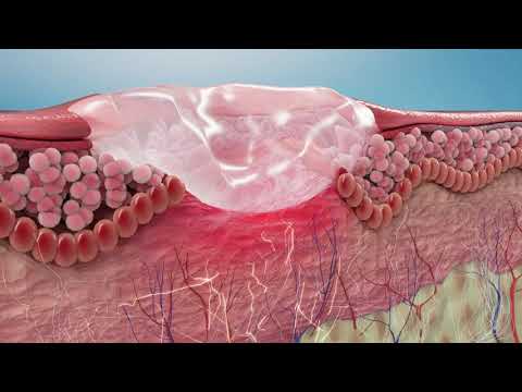 Vídeo Corporativo 3D Farma: Afta Lacer - Presentación de Producto