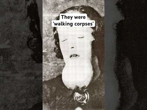 The Horrifying Story of The Radium Girls - Science's Dark Secret