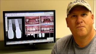 preview picture of video 'Canadian Dental Vacation to Tijuana Mexico'
