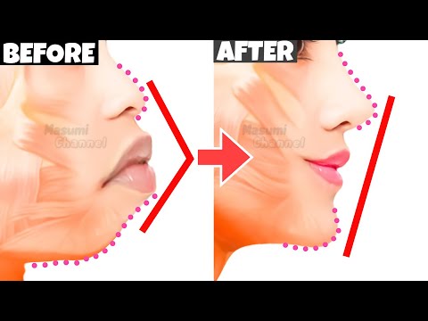 Get a Best Profile of BTS KIM TAEHYUNG!! Fix Protruding Mouth, Overbite | Get a Shaped Small Lips