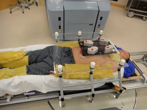 New treatment for scleroderma has given a Saskatoon man another chance at life