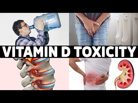 #1 Sign That You Overdosed on Vitamin D