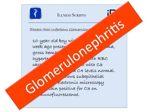 Postinfectious (Post-streptococcal) Glomerulonephritis Illness Script - USMLE, Medicine, Pediatrics