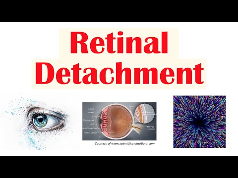 Subconjunctival Hemorrhage Blood in Eye Causes Signs Symptoms Diagnosis Treatment