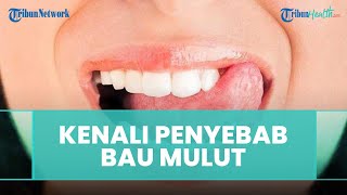 Penyebab dan Cara Mengatasi Bau Mulut Menurut drg. R. Ngt. Anastasia Ririen Pramudyawati