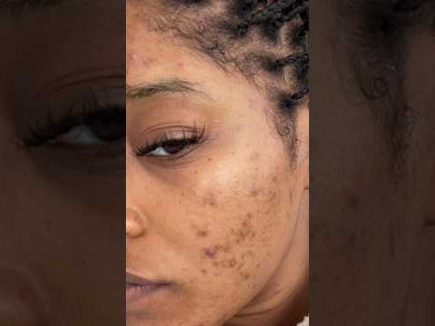 Tomatoes for skincare.