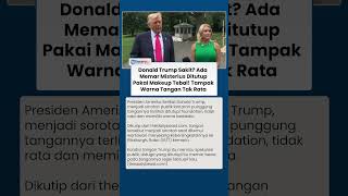 Diduga Sakit, Tangan Trump Ada Memar Misterius Ditutupi Pakai Make Up Tebal, Warna Tangan Tak Rata