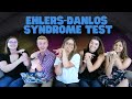 Hypermobile EDS Diagnostic Criteria On 5 People w/ Ehlers-Danlos