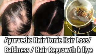 Ayurvedic Hair Tonic जिसस गंजे सर पर भी आते है घने और मुलायम बाल|Treat hair loss  &amp; dry damaged hair