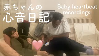 🤰🏻妊娠  | 生きてるか不安すぎてドップラー買いました。 #心音 #妊娠初期 #フランス生活