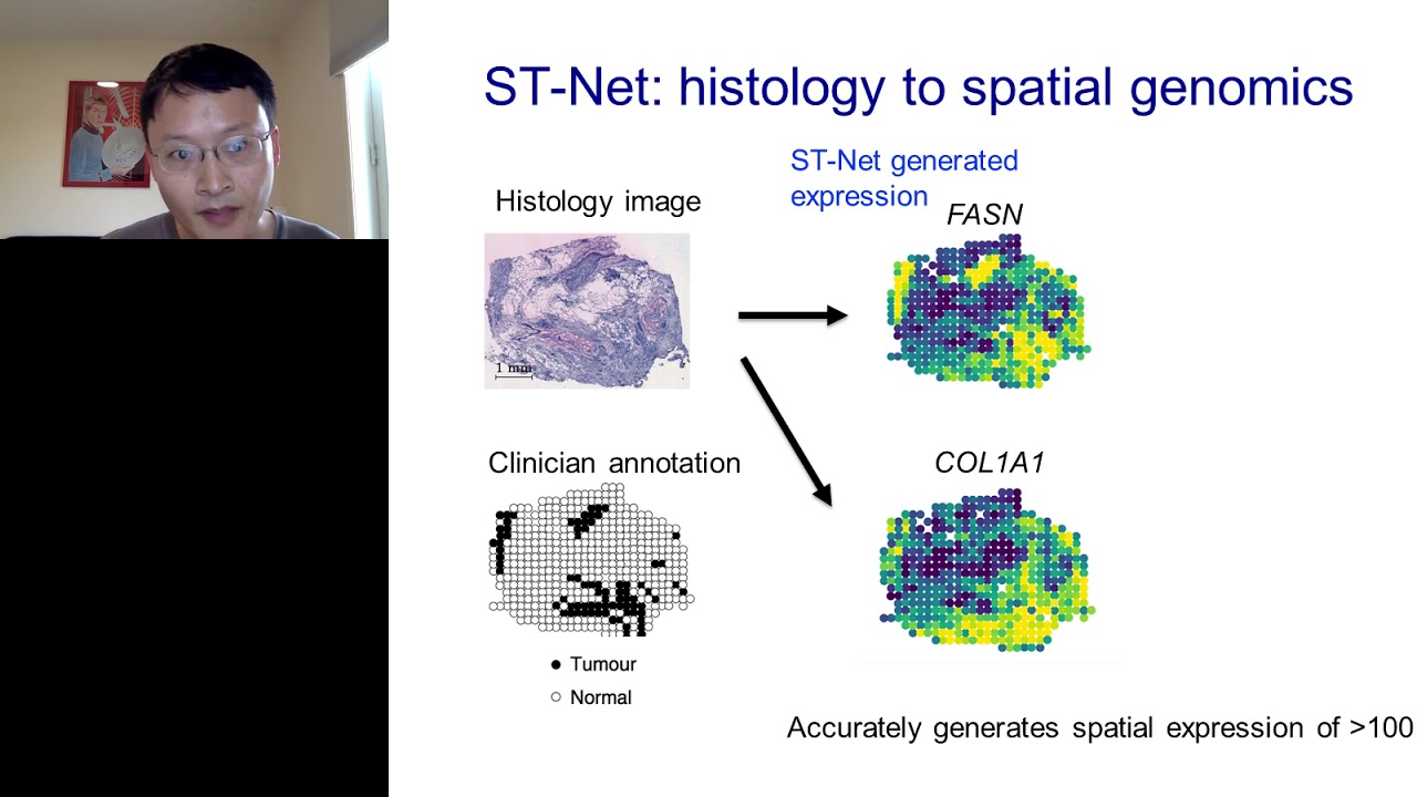 Deep learning to integrate histology with spatial transcriptomics