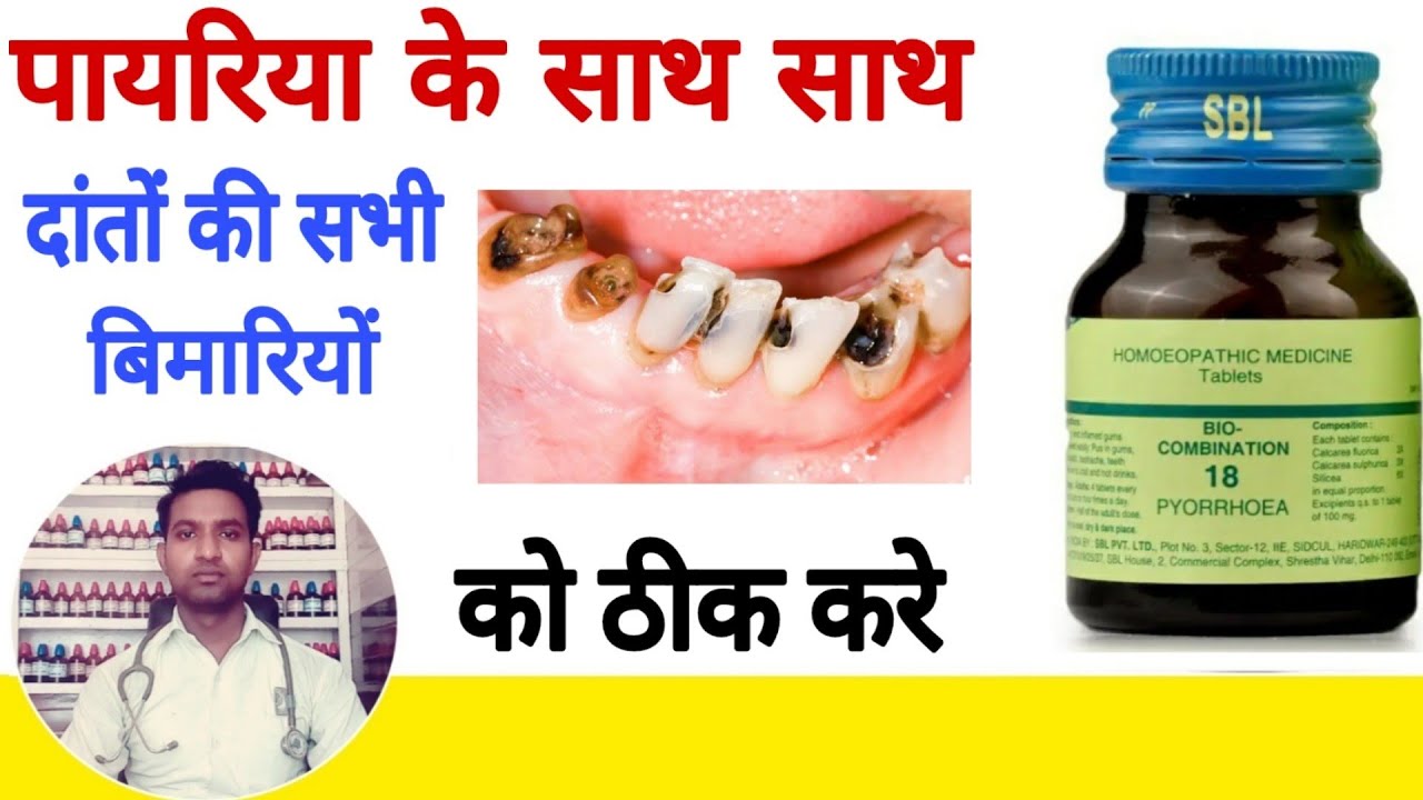 Biocombination 18 homeopathic medicine for theething problam