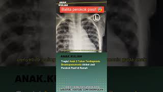 Download lagu ANAK 2 TAHUN KENA BRONKOPNEUMONIA AKIBAT ASAP ROKOK!? #anakkuliah #reels #viral #bayi #merokok #fyp mp3