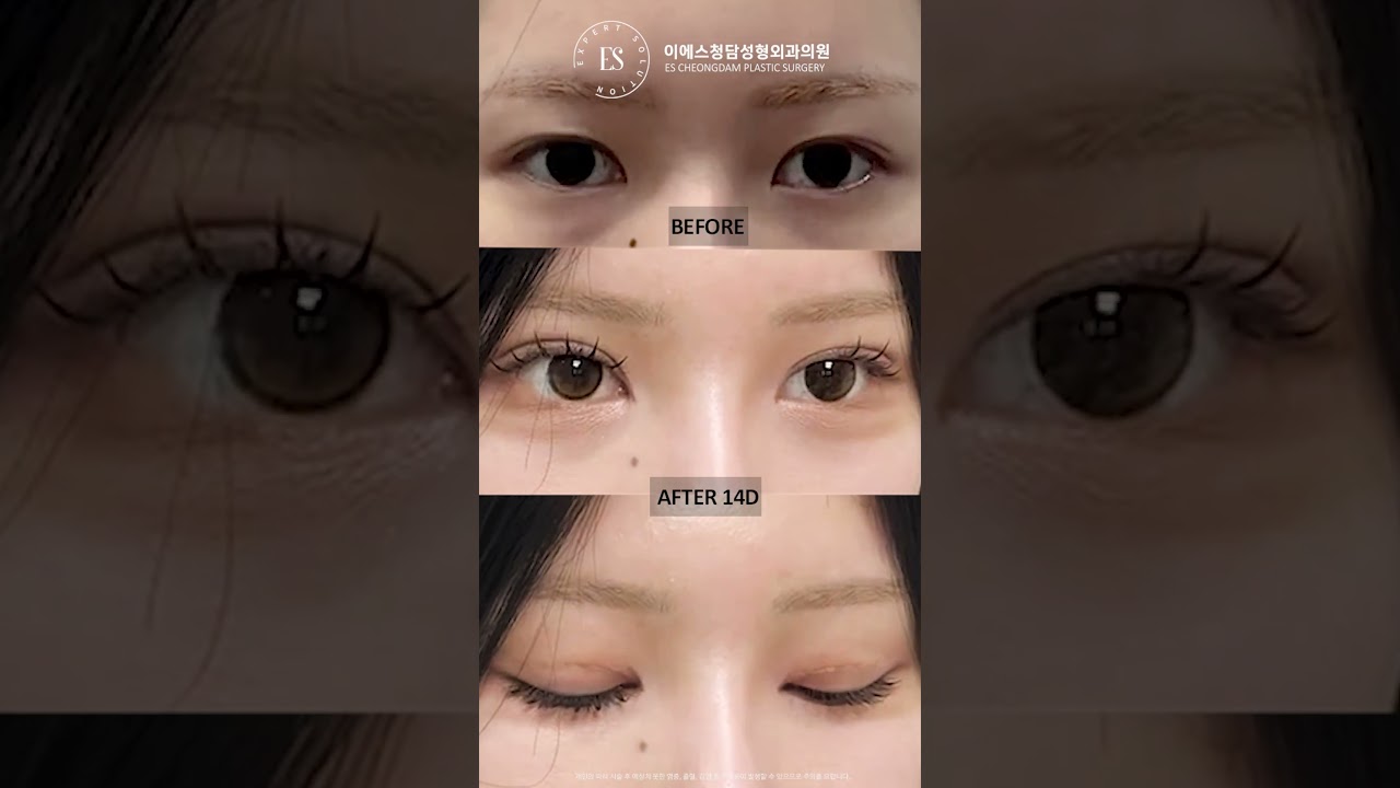 이에스 유튜브