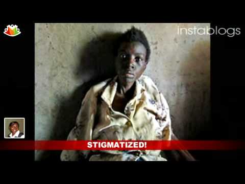 Malawians struggle to fight HIV AIDS stigma