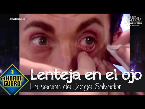 Pablo Motos se puso la lenteja en la lengua y la expulsó por el ojo - El Hormiguero