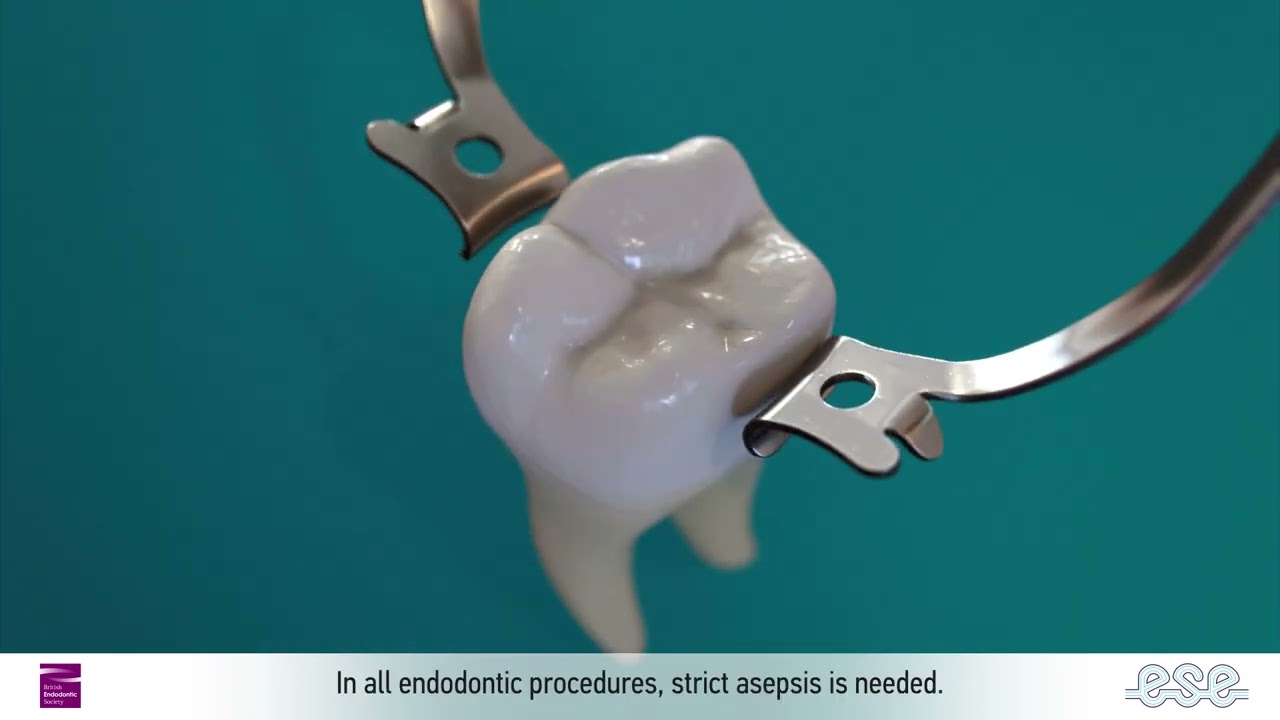 Why Save Your Natural Tooth? — British Endodontic Society