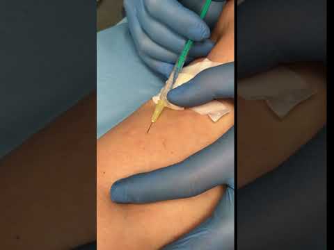 Bandage medical elastic în varicoză