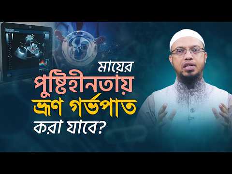 ৭ সপ্তাহের ভ্রূণকে মায়ের পুষ্টি সমস্যার আশঙ্কায় গর্ভপাত করা যাবে? | Shaikh Ahmadullah
