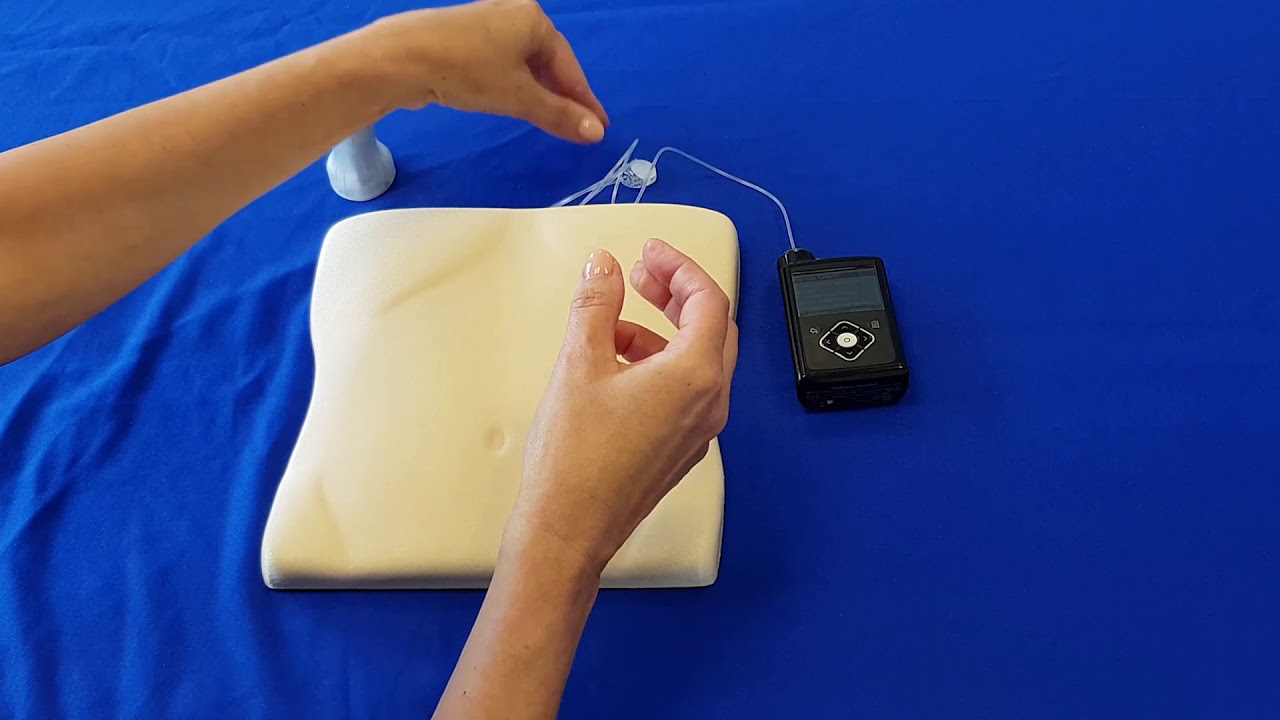 Wie wird das MiniMed™ Mio™ Advance Infusionsset eingeführt?
Produktmerkmale
Softkanüle aus Teflon, Einführwinkel 90°
Integrierte Einführhilfe
Versteckte Nadel vor und nach dem Gebrauch.
Ein hörbares Klicken" zeigt eine sichere Verbindung mit dem Infusionsset.
Ideal für Menschen mit Furcht vor Nadeln
Spezifikationen
Alle MiniMed™ Infusionssets und Reservoire sind perfekt aufeinander abgestimmt und sorgen dank der patentierten MiniMed™-Verbindung für eine sicherere Insulinabgabe.
Hörbarer 'Klick' bestätigt die sichere Verbindung
Silikonmembran macht das Reservoir wasserdicht
Ventile im Verbindungsstück dienen einer guten Insulinabgabe
Kanüle: Erhältlich in 6mm Softkanüle
Schlauch: Erhältlich in 60cm Länge
Kompatibilität: MiniMed™ Pumpen