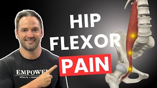 How To Fix Tight Hip Flexors