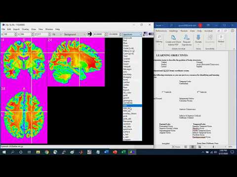 Intro to Brain Navigation with MRIcron Part1