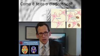 Diagnóstico de demência / Alzheimer - parte 2 da discussão