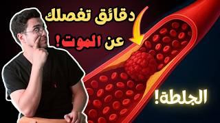 علاج الجلطات | كيفية تفادي تكّون الجلطات في الجسم | دليلك الشامل لعلاج الجلطات ☠️😱