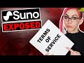Suno Exposed Terms Of Service Don T Release AI Music Until You Watch