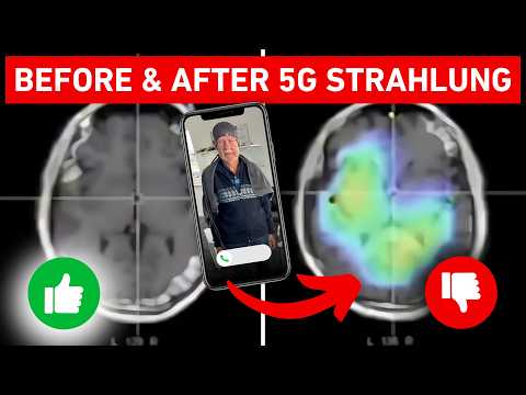 Dein Handy zerstört dein Gehirn – Prof. Spitz macht schockierenden 5G-Selbstversuch!