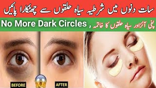 How to Remove Dark Circle/Get Rid of Dark Circles Naturally in 7 Days /Remove Under Eye Bags
