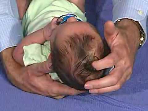 physical exam -Newborn Normal:  Head Shape and Sutures