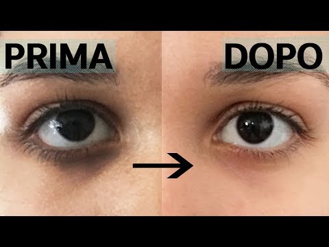 La riabilitazione dopo il recupero del ginocchio artroscopia ICD-10, linfortunio al polso