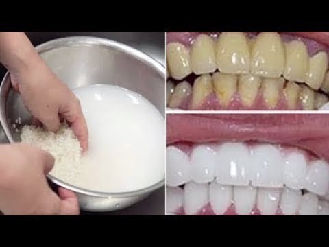 Làm Trắng Răng Đơn Giản &quotTHẦN TỐC&quot Bằng Nước Gạo Cực Nhanh