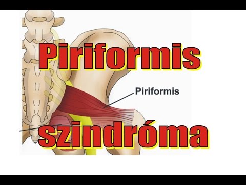 miért fáj a csípőízület séta után