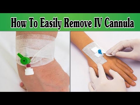 IV Cannula Colour And Size Cannula Types And Uses