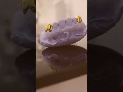 Gold Fangs by Urban Smiles Dental Clinic