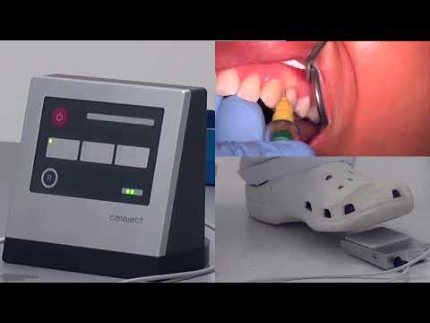 Calaject Computer Assisted Dental Injections from GoldenDent - No pain dental injections