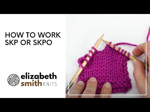 So funktioniert SKP oder SKPO