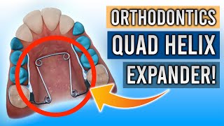 Quad Helix Expanders! | **EVERYTHING YOU NEED TO KNOW!**